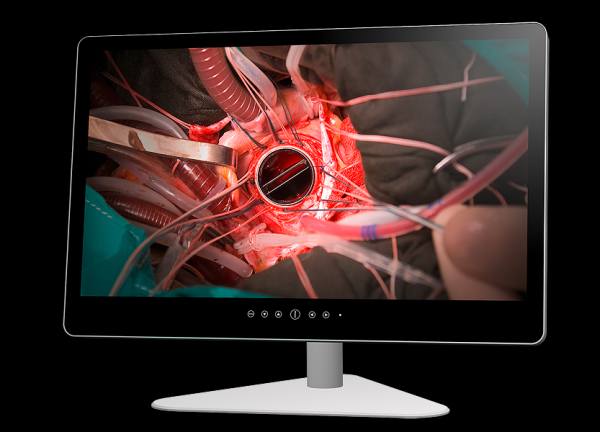 ADPZ_Panel PC_OR-PC-32''