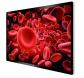 Panel PC médical OR-PC 55 4K 55