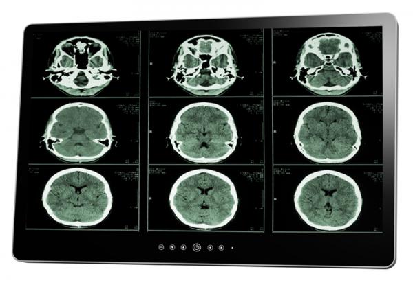 Ecran médical OR-MD 32'' Full HD