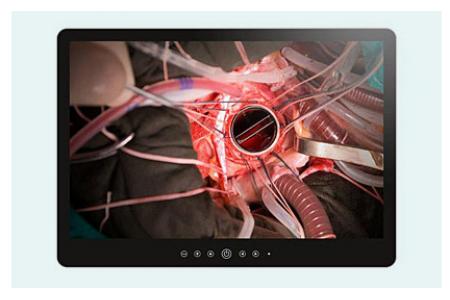 Ecrans médicaux étanches
