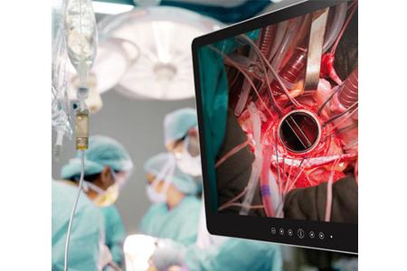 Ecrans médicaux 15'' au 42''